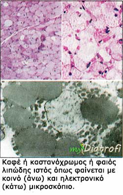 kafe-lipodis-istos-faio-lipos