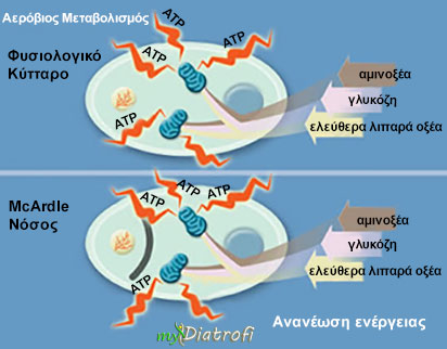 mcardle-nosos-syndromo-symptomata-kai-therapeia-1