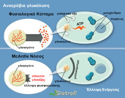 mcardle-nosos-syndromo-symptomata-kai-therapeia
