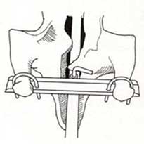 pos-denoume-to-arni-sti-soyvla-3
